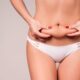 abdominoplastie diastasis abdominal