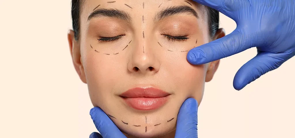 Combien de temps dure la convalescence après un lifting du visage ?