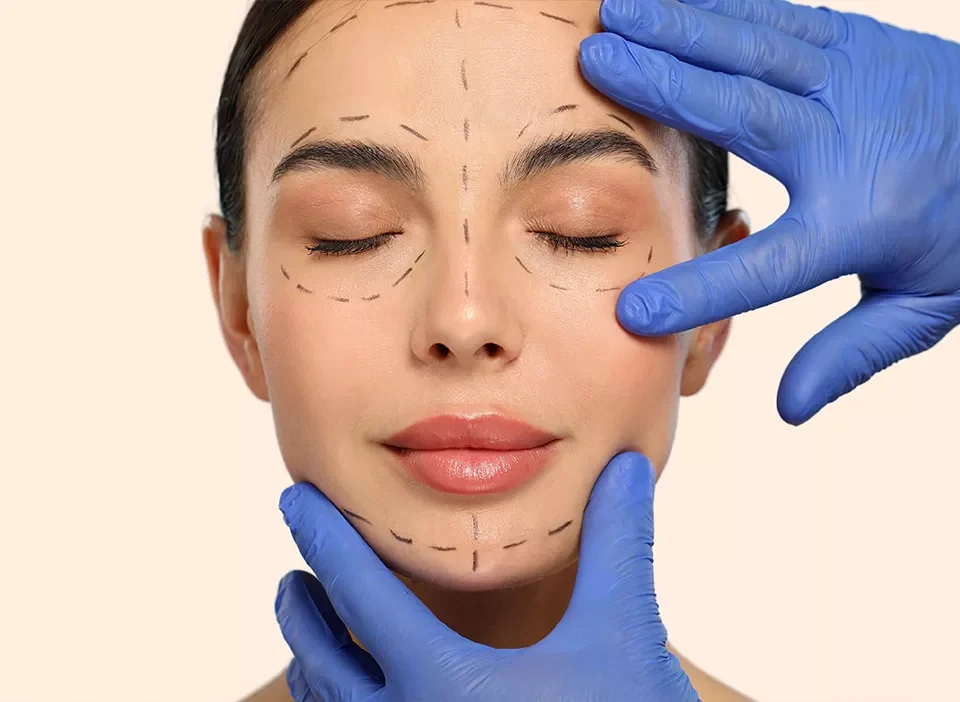 Combien de temps dure la convalescence après un lifting du visage ?