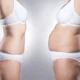 Quelle est la différence entre un bodylift et une abdominoplastie ?