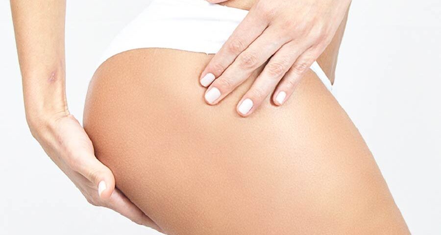 Lifting des fesses combiné à une liposuccion