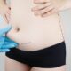 L’abdominoplastie est-elle indiquée chez les patientes atteintes de lipœdème