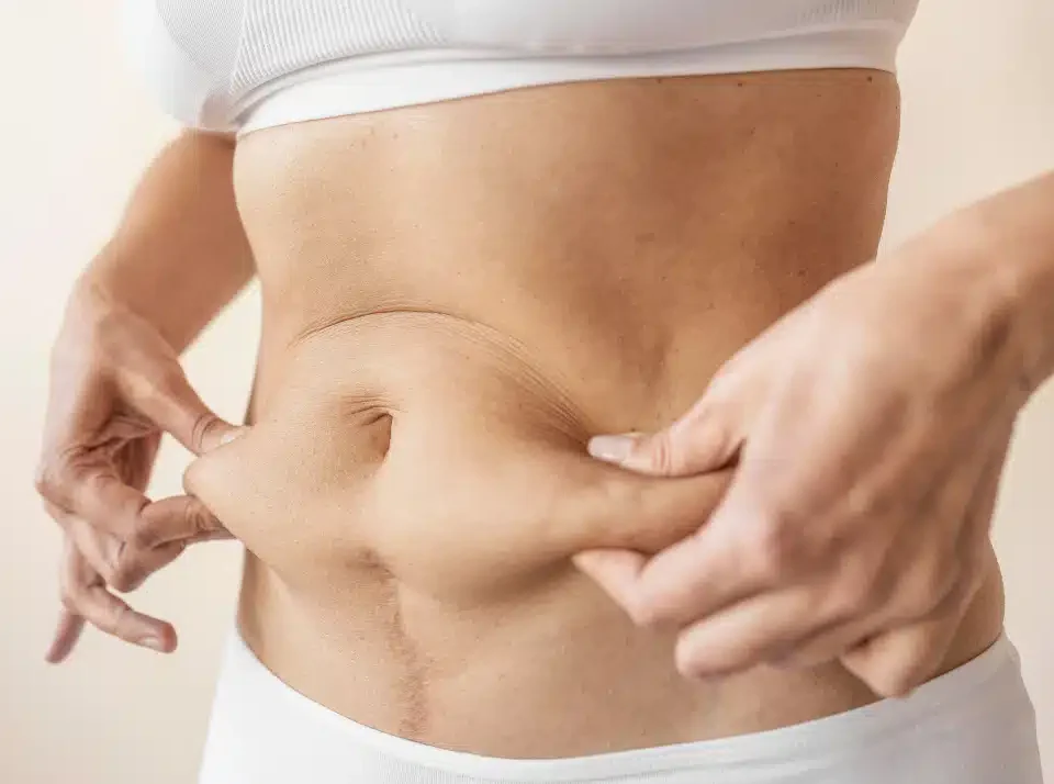 Lifting du ventre et correction de la diastasis des grands droits