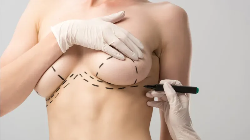 Lifting des seins et liposuccion